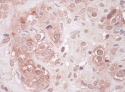 p62/SQSTM1 Antibody, Novus Biologicals 0.1mL; Unlabeled:Antibodies, Polyclonal
